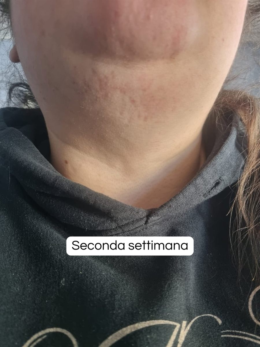 La stessa zona dopo due settimane di trattamento