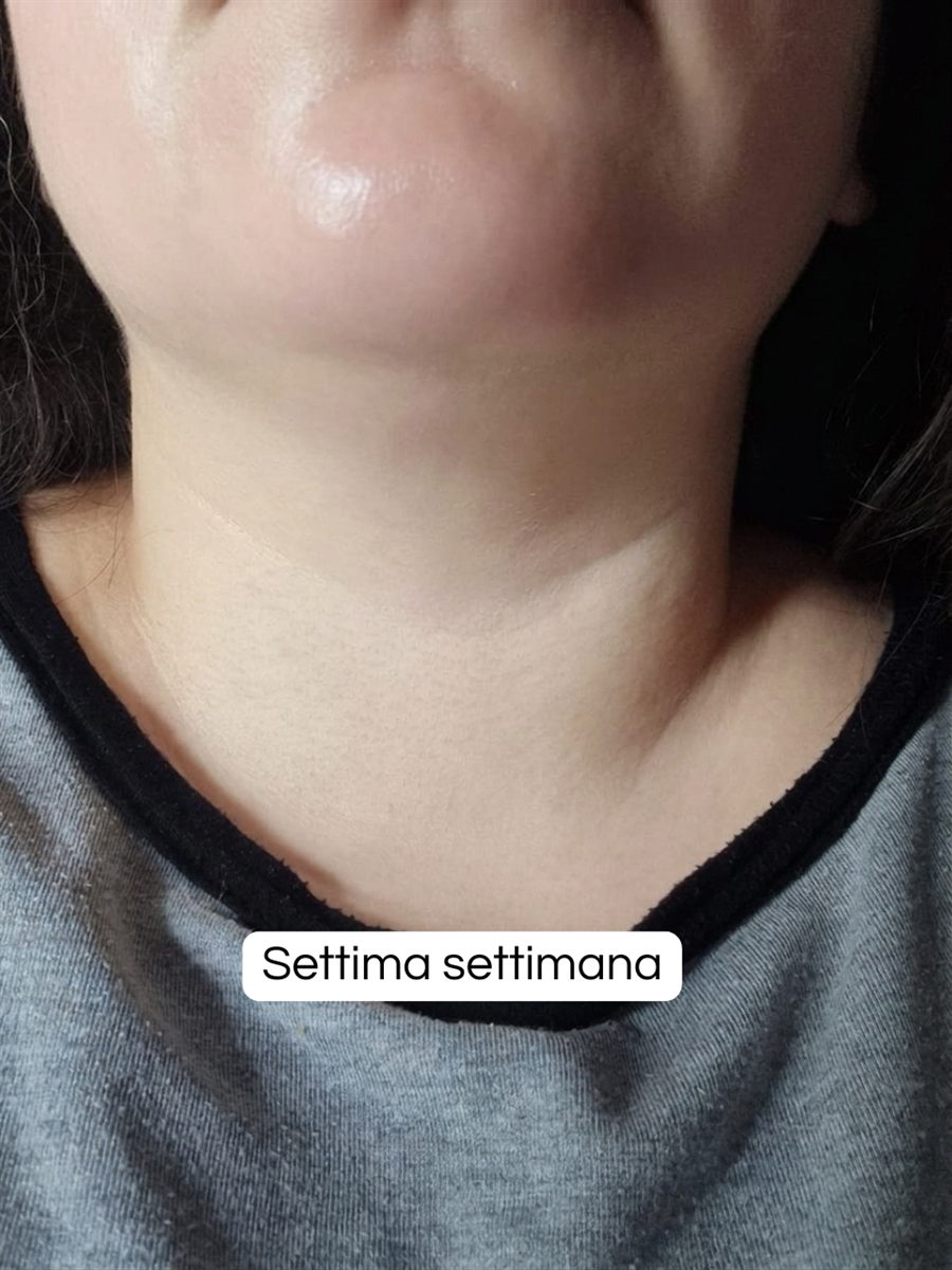 La stessa zona dopo sette settimane di trattamento